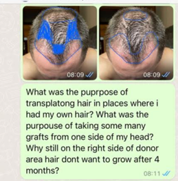 رسالة واتساب عيادة زراعة الشعر 6